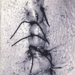 Infliction