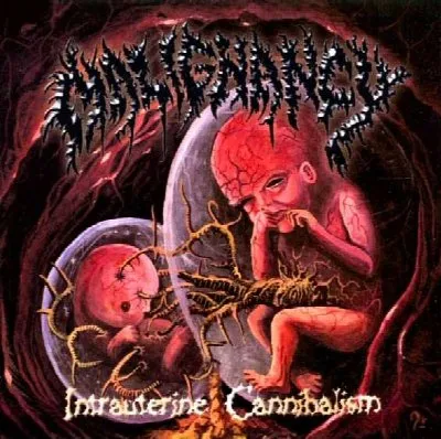 Intrauterine Cannibalism